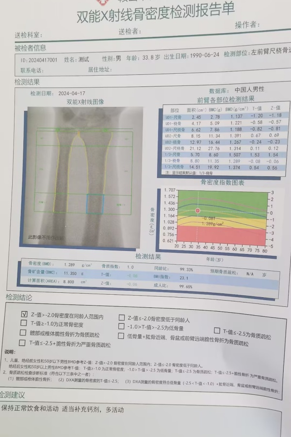 雙能X射線骨密度儀：準確測量骨密度，助力骨質疏松防治，守護骨骼健康